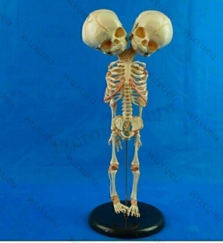 Baby Skelett mit Doppelkopf Modell Anatomie Lehrmodell Medizinische Neu - - Bild 1 von 7