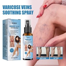 Vein Treatment Spray, Relieve Leg Soreness And Swelling Repair Earthworm Leg Vei