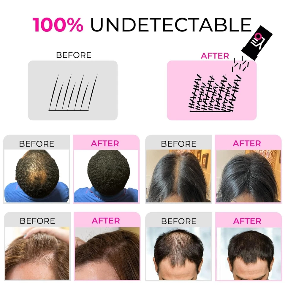 Hair Building Fibers 30g – Instant Thicker Fuller Hair for Thinning Areas - Image 4 of 4