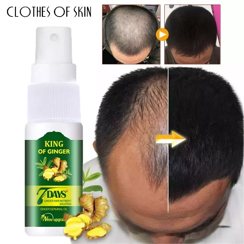 UK ReGrow 7 Day Ginger Germinal Hair Growth Serum for Men Women