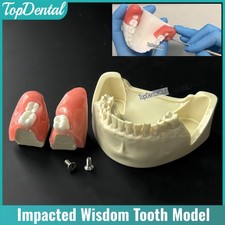 Dental Impacted Tooth Model Extraction Wisdom Teeth Practice Model Simulator