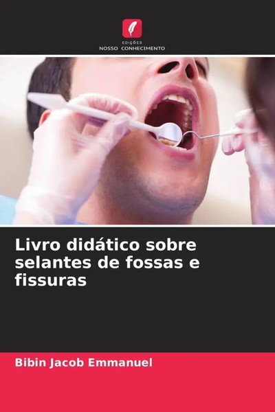 Bibin Jacob Emmanuel | Livro DidáTico Sobre Selantes De Fossas E Fissuras | Buch-image
