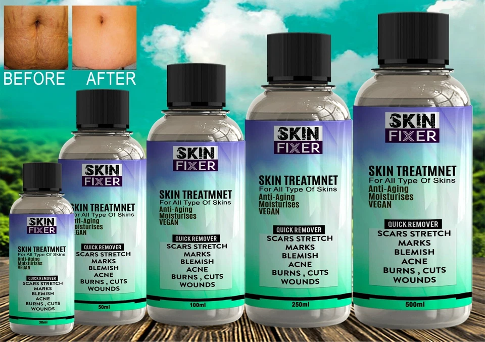 Fast Scar Acne Stretch Mark Removal Ointment Gel Treatment Wounds Cuts Burns🔥 ✅