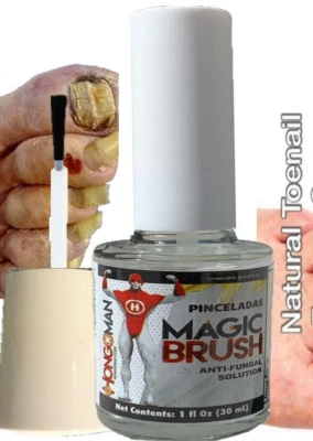 HONGOSAN ANTI-FUNGAL MAXIMUM STRENGTH TOENAIL FUNGUS ATHLETES FOOT FUNGI NAIL SUPPORT