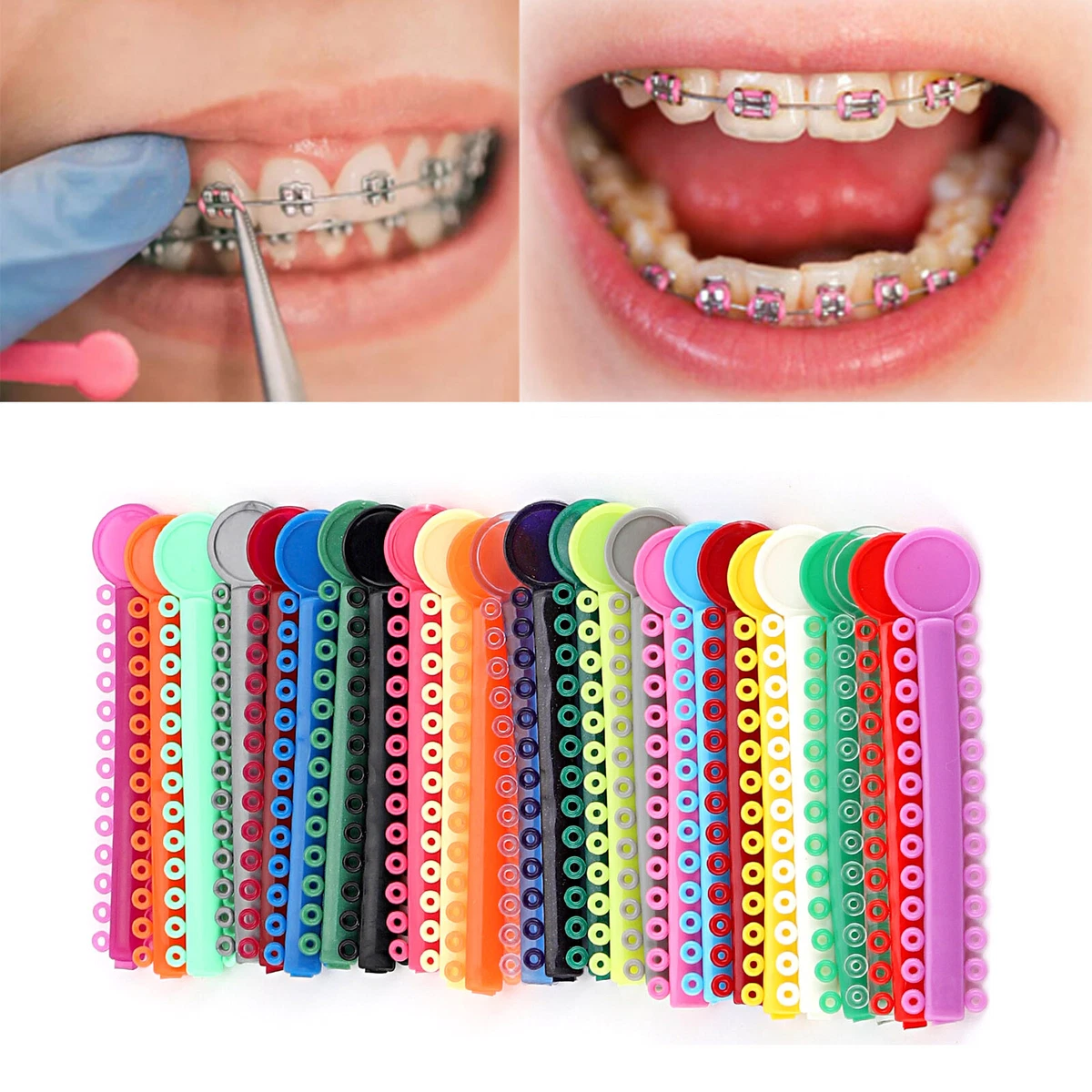 Braces on sale rubber color