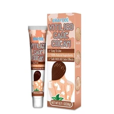 Vitiligo Cream, Natural Effective Treatment for Reduce White Spots... 