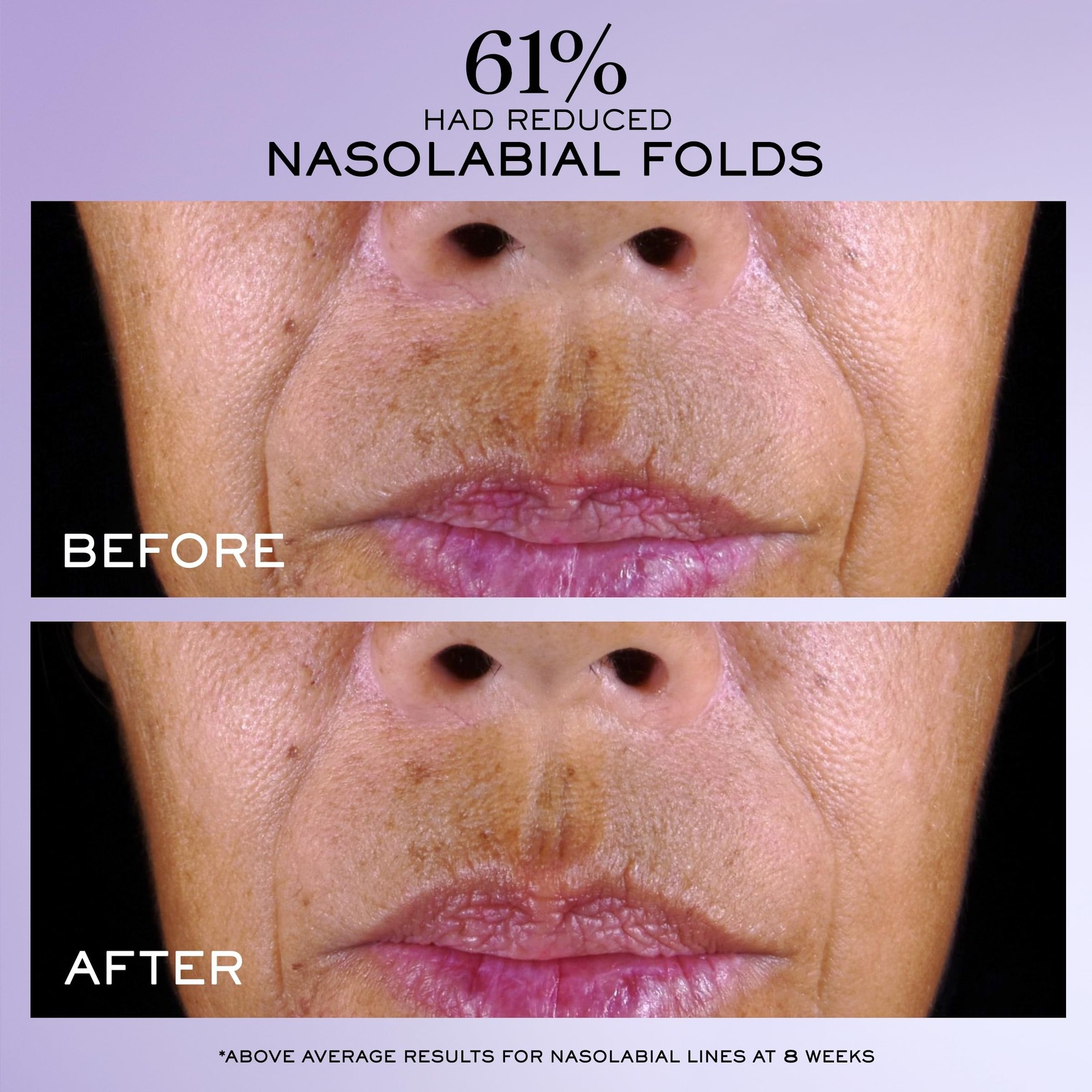 Lancôme Rénergie C.R.x. Triple Serum Retinol - Anti-Aging Serum With P