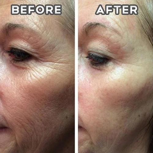 Mask Tea Green Clay Stick Purifying Deep Remover Blackhead Facial Control Mud - Picture 5 of 9