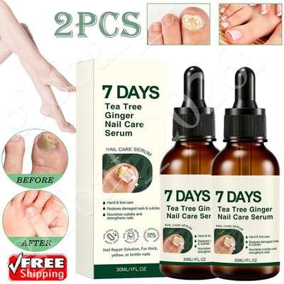 7 DAYS Nail Fungus Treatment Serum Care Hand and Foot Care Removal 30ml(Pack1-2)