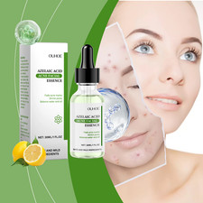Acne Serum with Azelaic Acid for Oil Control Pore Refining and Hydrating Formula