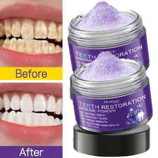2 Pack Dental Restoration Mineral Powder, Mineral Tooth Powder, Teeth Whitening