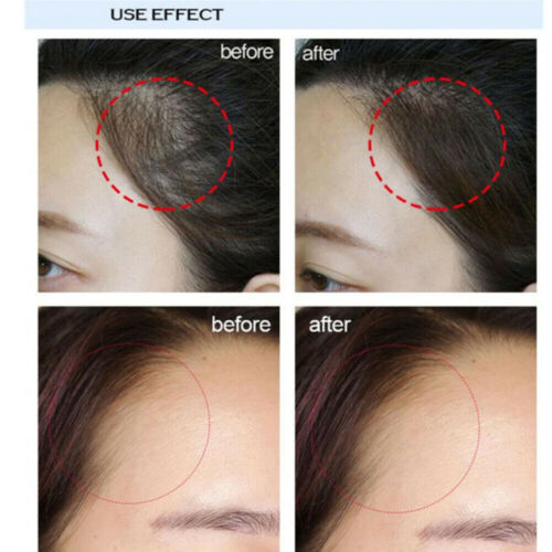 Waterproof Hair Line Filler Filling Powder Hairline Instant Cover Up Shadow NEW - Picture 17 of 37
