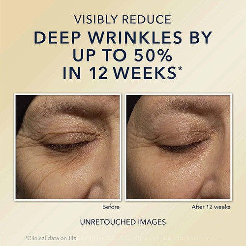 RoC Retinol Correxion Deep Wrinkle Night Cream 1 fl oz /Free Worldwide Shipping - Picture 16 of 18