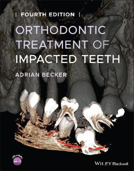 Orthodontic Treatment Of Impacted Teeth, Adrian Becker-image