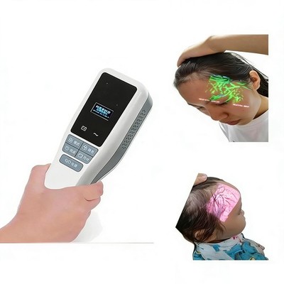 Medical Vein Finder - Handheld Infrared Device for Blood Draws & IV Insertion