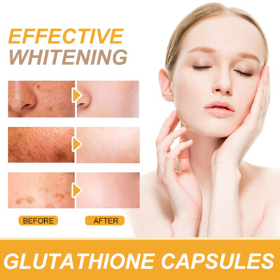 liposomal glutathione skin whitening effectiveness Liposomal Glutathione Pure Reduced L-Glutathione Detox Skin Whitening 120  Caps