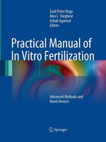 Zsolt Peter Nagy (U. A.) | Practical Manual Of In Vitro Fertilization | Buch