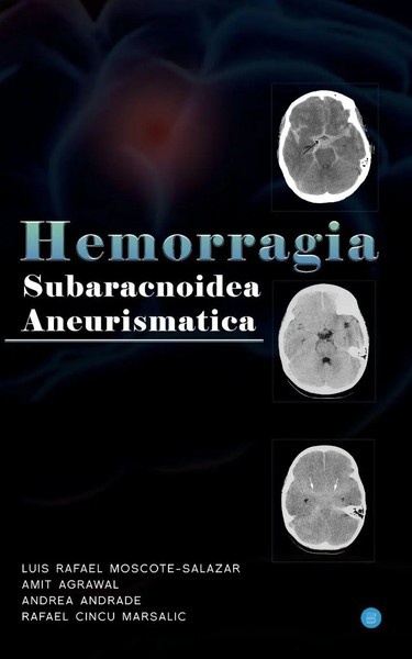 Amit Agrawal | Hemorragia Subaracnoidea Aneurismatica | Taschenbuch | Englisch-image