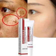 Powerful Spot-removing Whiten Cream Pigmentation Melasma Dark Spots UK