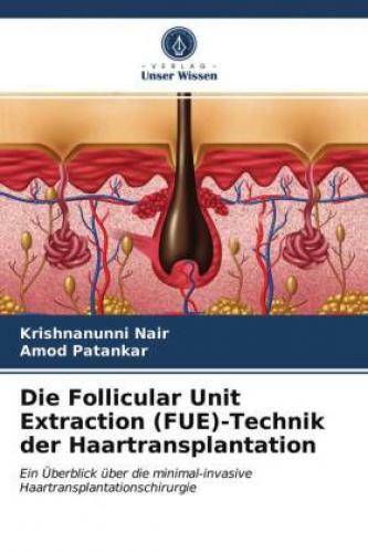 Thumbnail - Die Follicular Unit Extraction (fue)-technik Der Haartransplantation