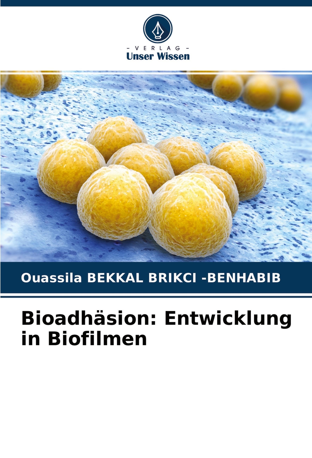 Thumbnail - Bioadhäsion: Entwicklung In Biofilmen Ouassila Bekkal Brikci -benhabib