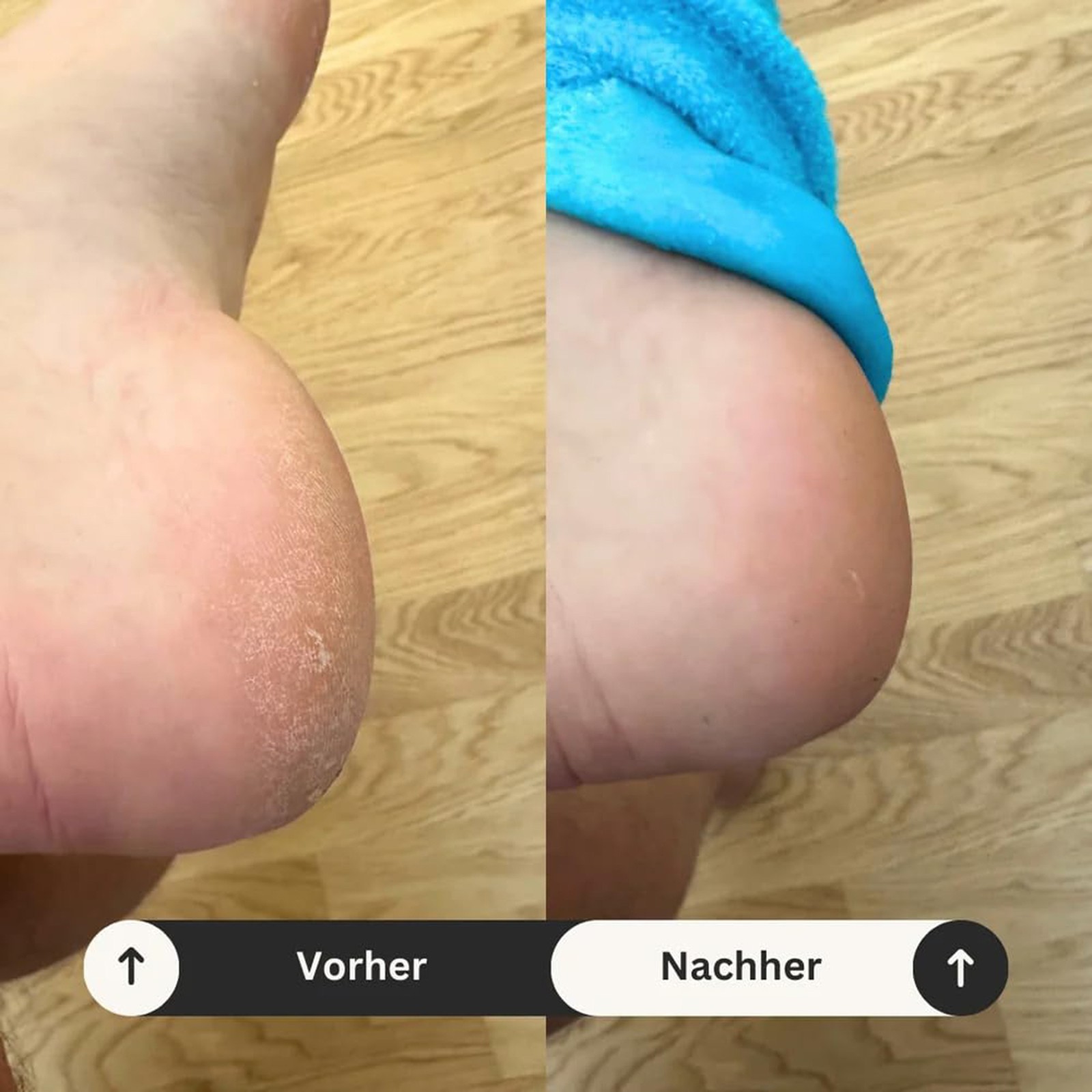 Moisturizing Heel Socks 2x Women Soft Breathable Spa Heel Socks for Dry Heels