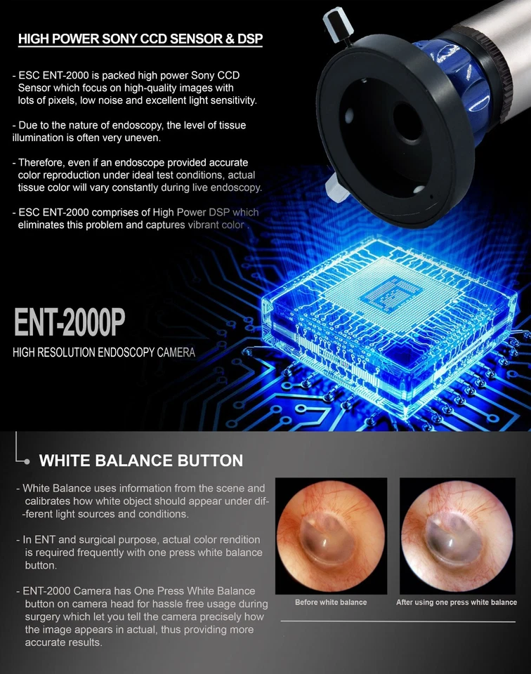 Portable Endoscopy Camera HD Rigid Endoscope 1.2MP Medical ENT w/ Coupler - Image 4 of 4