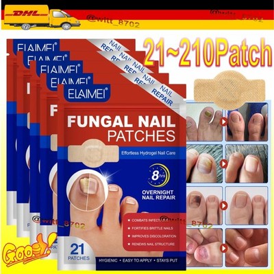 21~210Pcs Toenail Antiseptic Patch Long Lasting Breathable Fungal Nail Patche DE