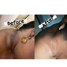 Dark knuckle Skin Whitening lightening Kojic acid, Glycolic acid, AHA Cream