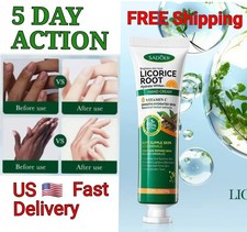 Fast Whitening Dark Knuckles Hand Cream Brightening Repair Moisturizing Skin 20g