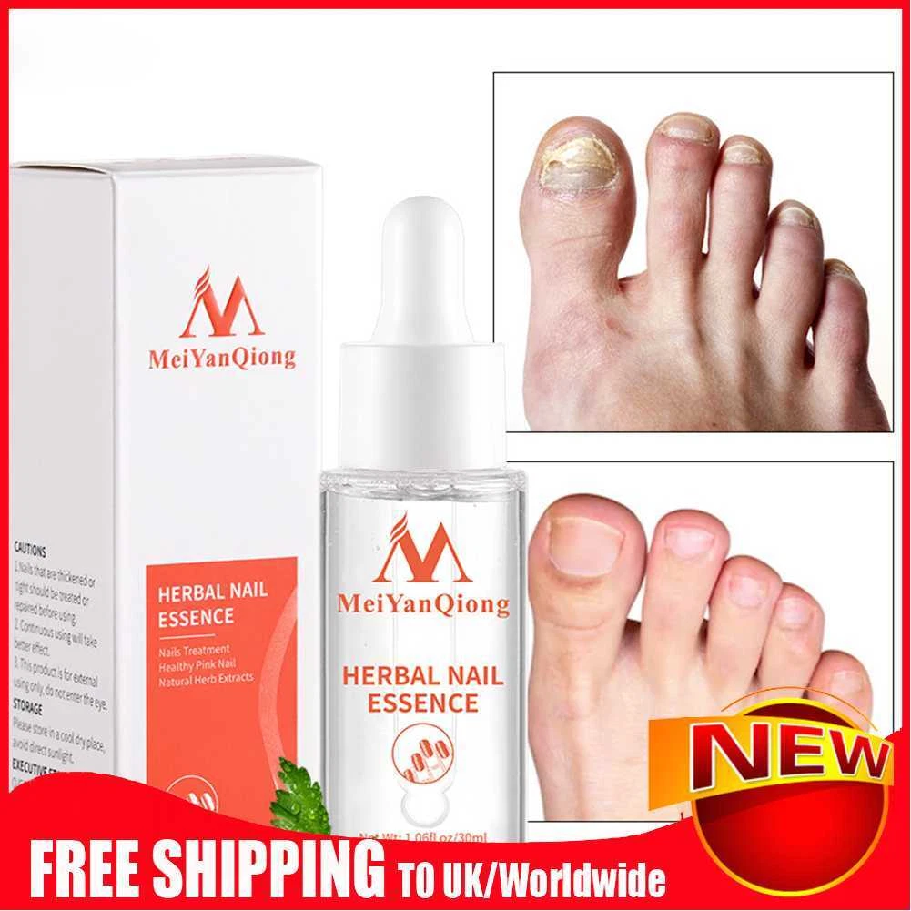 Aggregate more than 138 nail whitening products best ceg.edu.vn