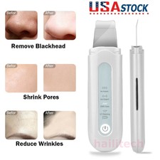 Facial Ultrasonic Skin Scrubber Spatula Face Extractor Peeling Tool Deep Cleaner For Sale Online Ebay