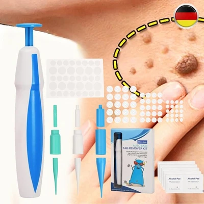 MARKENLOS 2-IN-1 Auto Skin Tag Removal Tool Kit Painless Skin Label Mole Acne Wart Removal