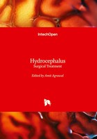 Amit Agrawal | Hydrocephalus - Surgical Treatment | Buch | Englisch (2025)