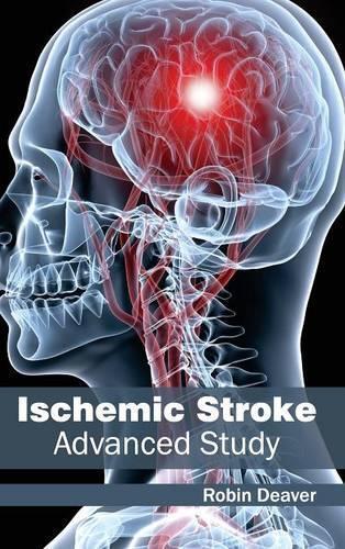 Thumbnail - Ischemic Stroke: Advanced Study (gebundene Ausgabe) (us Import)
