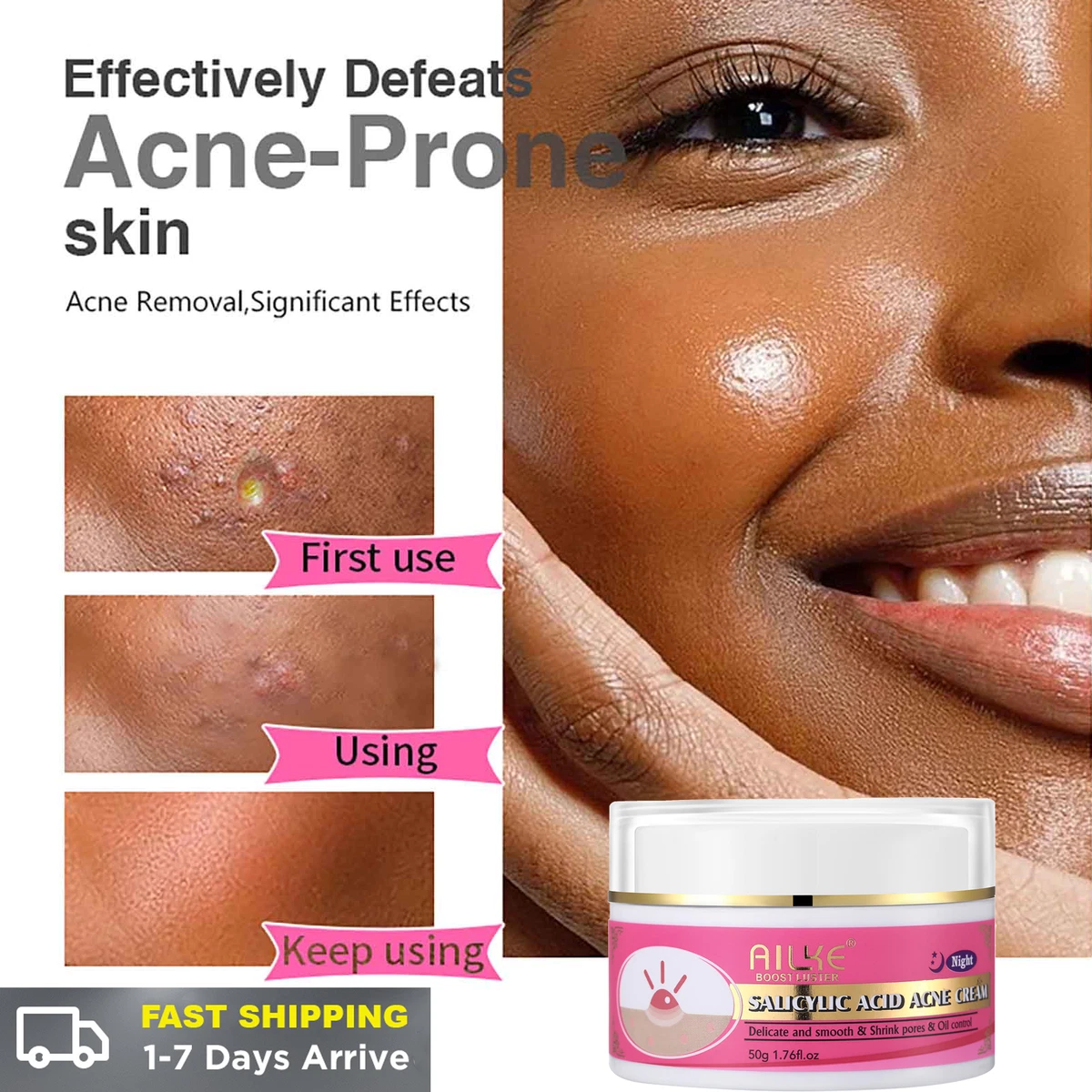 Blackheads On Face Removal Cream