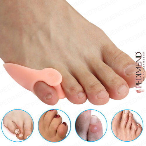 PEDIMEND Small Toe Separator Pinky Toe Corrector Little Toe Straightener - Foot - Picture 2 of 9