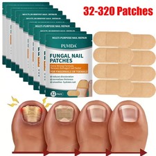 32-320Pcs Natural Fungal Nail Patches - Extra Strength Toenail Fungus Treatment