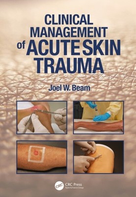 Clinical Management of Acute Skin Trauma by Joel W. Beam PAPERBACK 9781638220664