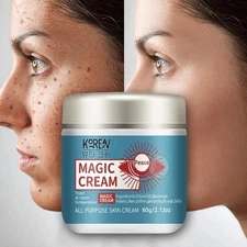 Whitening Freckle Cream Remove Dark Spot Cream Removal Melanin Melasma 2 fl oz