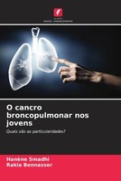O Cancro Broncopulmonar Nos Jovens Quais SãO As Particularidades? Smadhi (U. A.)