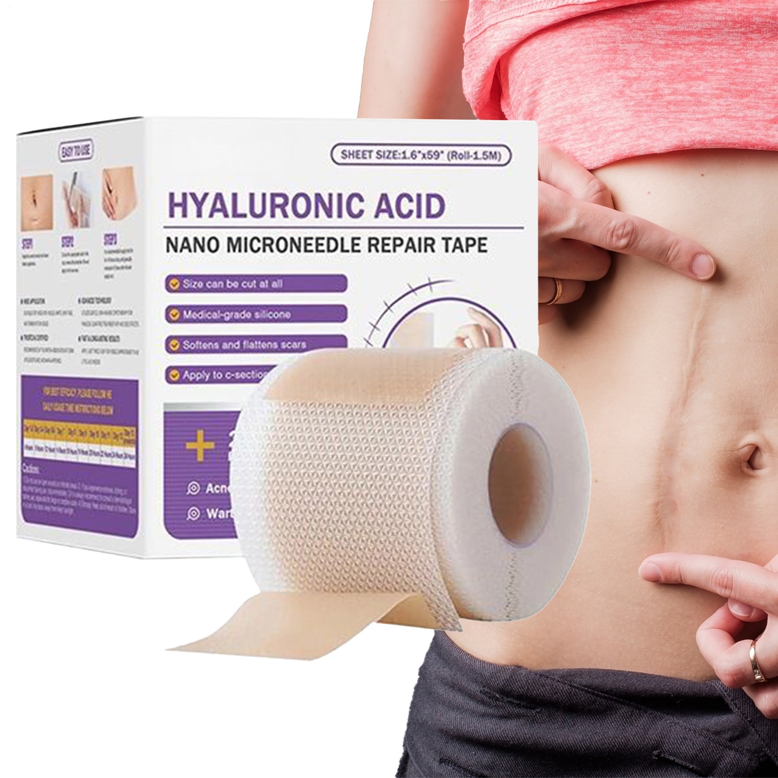 Hyaluronic Acid Nano Microneedle Scar Repair Silicone Tape-image