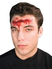 Grand Opening Prosthetic Appliance - Morris