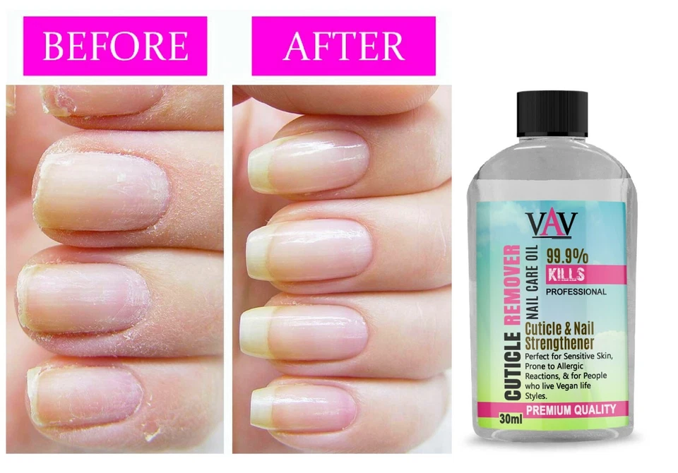 VAV NAGELHAUTENTFERNER Weichspüler Gel Creme Nägel Hybrid Maniküre 30ml schnelle Lieferung