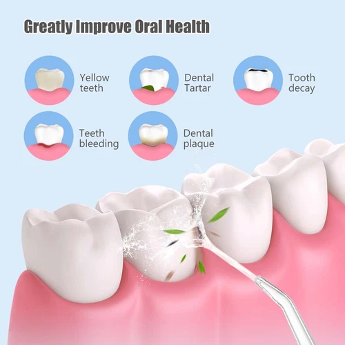 Cordless Water Flosser Jet 4 Tips Dental Floss Oral Irrigator Teeth Cleaner USB - Bild 8 von 10