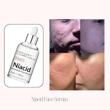 Natural Niacid Face Serum for brightening skin, Blemishes  Oil Control 50 ml