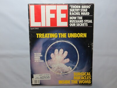 LIFE MAGAZINE APRIL 1983 THORN BIRDS RACHEL WARD TREATING UNBORN 7Gx2