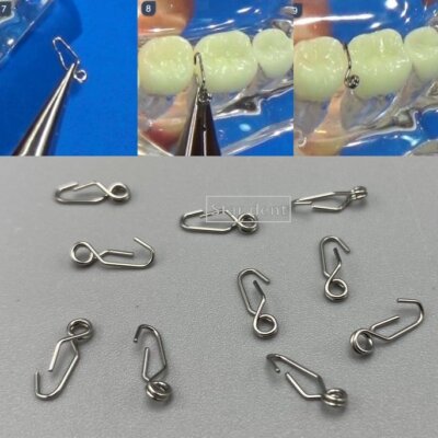 Tooth Separating Spring Dental Ortho Self-Lock Separating Springs Separate Steel Separator ...