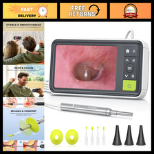 Digital Otoscope with 4.5" Screen, 3.9mm Camera, Ear Wax Removal Tool, 32GB Card