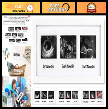 Triple Sonogram Pregnancy Frame - Baby Ultrasound Picture Holder, 3 Trimesters D
